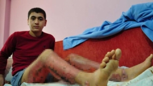 Iraklı mülteci çocuğun dramı