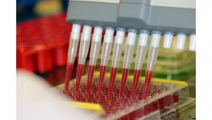 Türkiye'de yetişen 4 bitki türü 'sıtma' hastalığına deva olacak