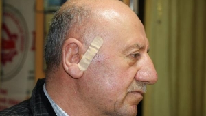 Sopayı gören çarşaflı soyguncular kaçtı