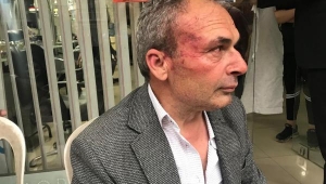 Belediyede işten çıkarılan 2 kişi Başkan Yardımcısını darp etti